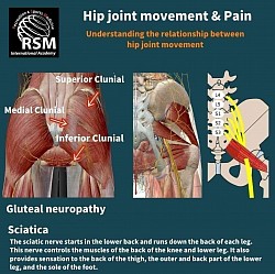 痛みの原因となる活性トリガーポイントの触診技術を習得します。坐骨神経痛や中臀皮神経の滑走障害による痛みの触診技術を習得します。痛みによる姿勢変化も学びます
